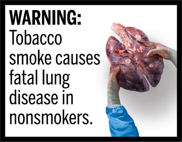 g02_lung_disease--1-.jpg